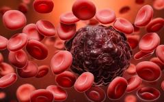 Leukemia Cancer Treatment Cost In India | Healzone