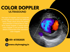 Colour Doppler Test Price Affordable Rates