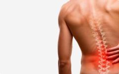 Back Pain Doctor In West Orange, New Jersey