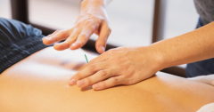 Best TCM Acupuncture