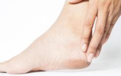 Restore Soft, Healthy Feet with Cracked Heels Treatment