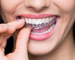 Find the Best Invisible Braces for a Perfectly Aligned Smile