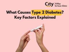 What Causes Type 2 Diabetes? Key Factors Explained