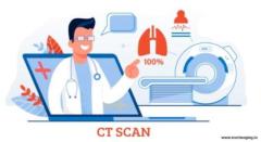 CT scan chest price