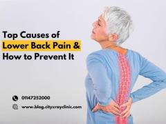 Top Causes of Lower Back Pain & How to Prevent It