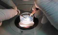 Sperm Freezing Cost in Delhi: What to Expect